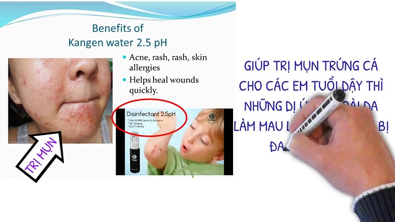 Nước pH 2.5 thường dùng khi cần vệ sinh, khử trùng
